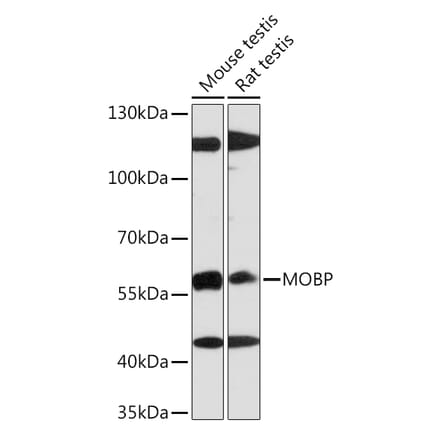 Western Blot - Anti-MOBP Antibody (A91716) - Antibodies.com