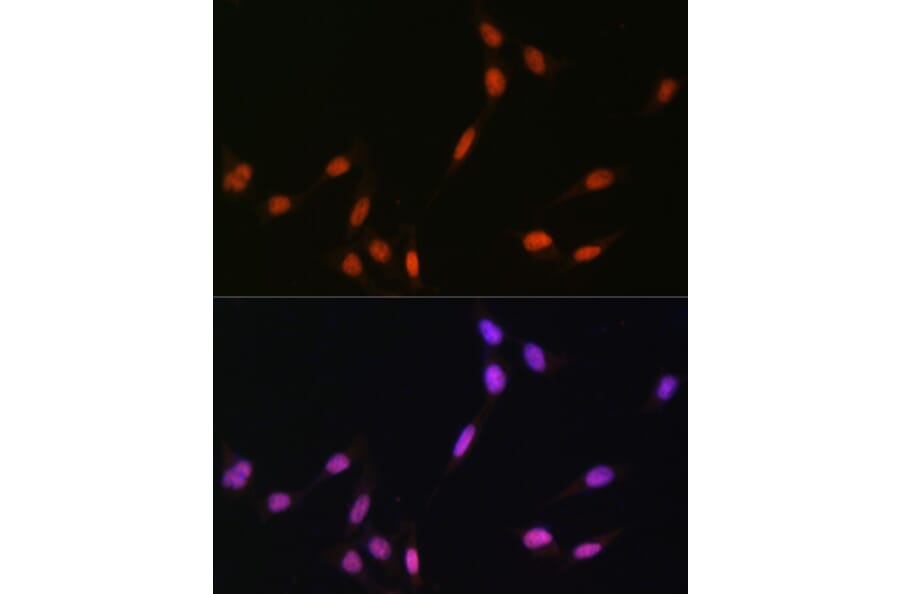 Immunofluorescence - Anti-Histone H4 (mono methyl Lys5) Antibody (A91717) - Antibodies.com