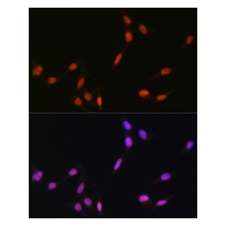 Immunofluorescence - Anti-Histone H4 (mono methyl Lys5) Antibody (A91717) - Antibodies.com