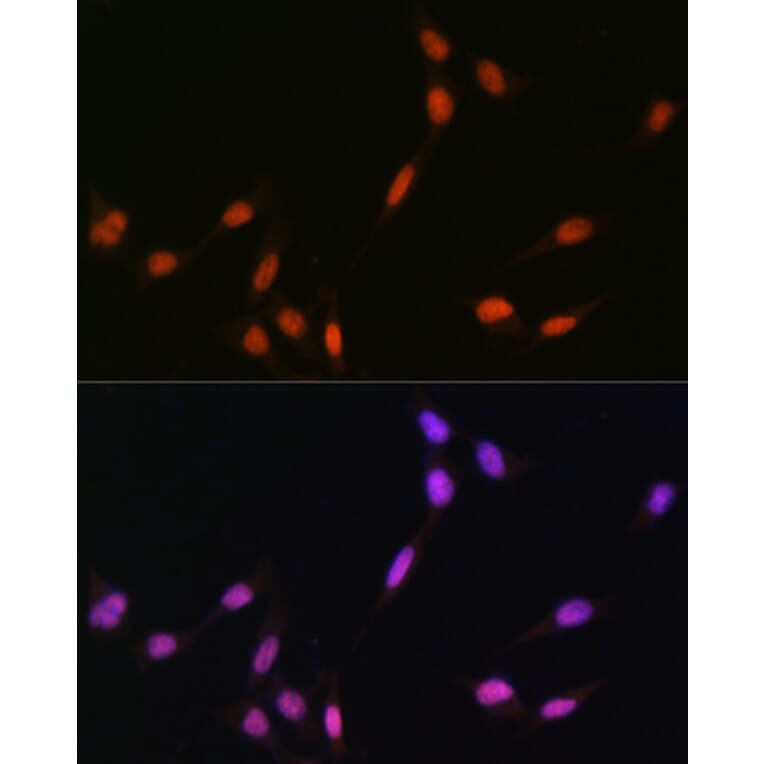 Immunofluorescence - Anti-Histone H4 (mono methyl Lys5) Antibody (A91717) - Antibodies.com