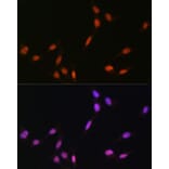 Immunofluorescence - Anti-Histone H4 (mono methyl Lys5) Antibody (A91717) - Antibodies.com