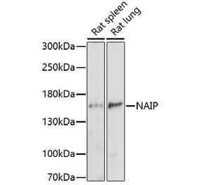 Western Blot - Anti-NAIP Antibody (A91719) - Antibodies.com