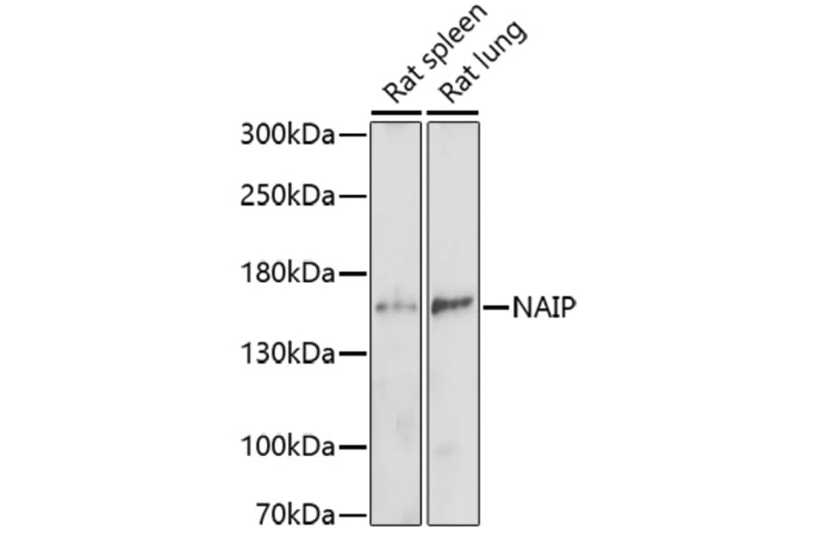 Western Blot - Anti-NAIP Antibody (A91719) - Antibodies.com