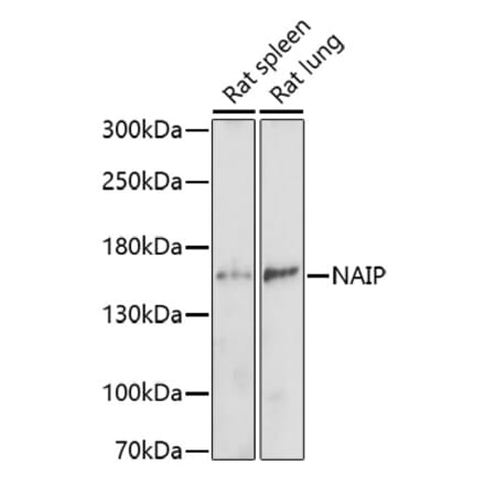 Western Blot - Anti-NAIP Antibody (A91719) - Antibodies.com