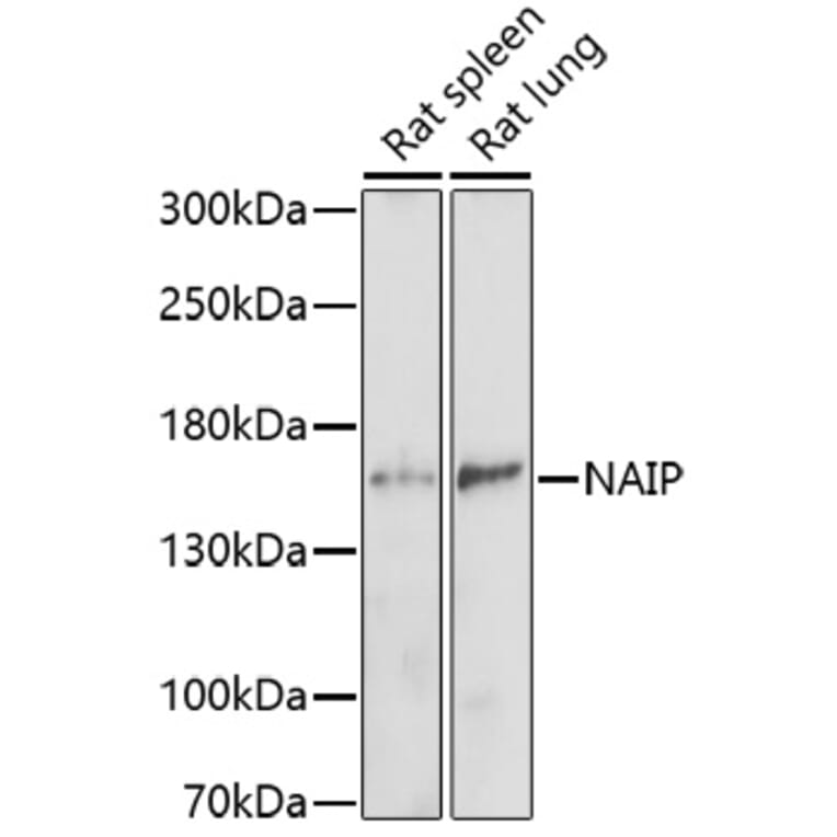 Western Blot - Anti-NAIP Antibody (A91719) - Antibodies.com