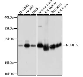 Western Blot - Anti-NDUFB9 Antibody (A91720) - Antibodies.com