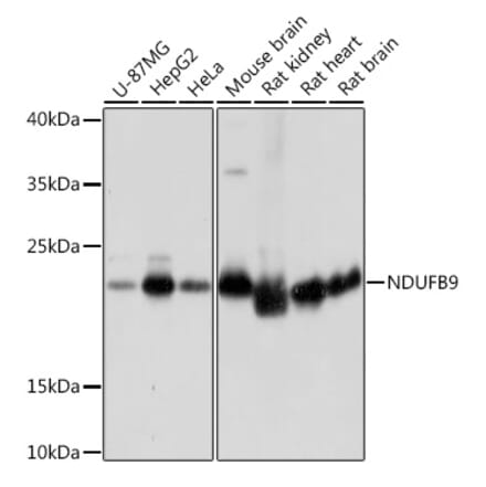 Western Blot - Anti-NDUFB9 Antibody (A91720) - Antibodies.com