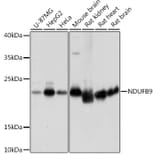Western Blot - Anti-NDUFB9 Antibody (A91720) - Antibodies.com