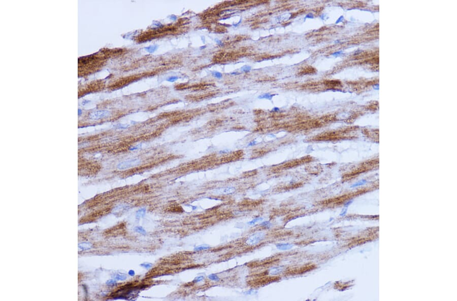 Immunohistochemistry - Anti-NDUFB9 Antibody (A91720) - Antibodies.com