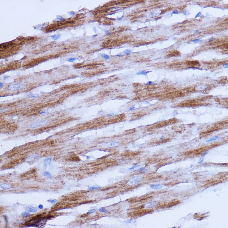 Immunohistochemistry - Anti-NDUFB9 Antibody (A91720) - Antibodies.com