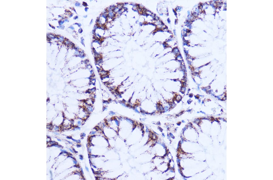Immunohistochemistry - Anti-NDUFB9 Antibody (A91720) - Antibodies.com