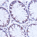Immunohistochemistry - Anti-NDUFB9 Antibody (A91720) - Antibodies.com