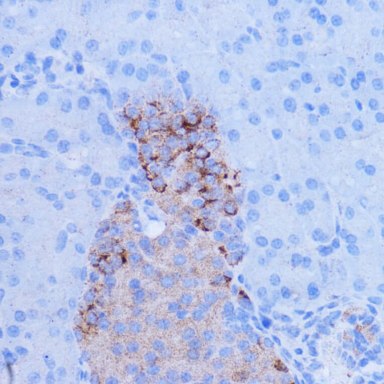Immunohistochemistry - Anti-NDUFB9 Antibody (A91720) - Antibodies.com