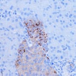 Immunohistochemistry - Anti-NDUFB9 Antibody (A91720) - Antibodies.com