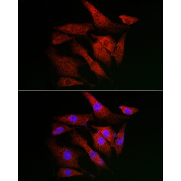 Immunofluorescence - Anti-IKB alpha Antibody (A91723) - Antibodies.com