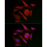 Immunofluorescence - Anti-IKB alpha Antibody (A91723) - Antibodies.com