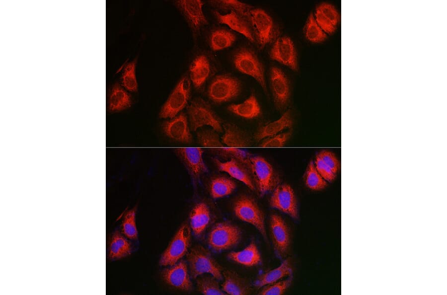 Immunofluorescence - Anti-IKB alpha Antibody (A91723) - Antibodies.com
