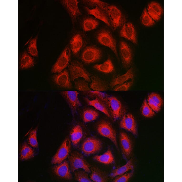 Immunofluorescence - Anti-IKB alpha Antibody (A91723) - Antibodies.com