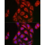 Immunofluorescence - Anti-IKB alpha Antibody (A91723) - Antibodies.com