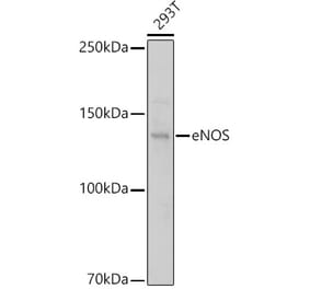 Western Blot - Anti-eNOS Antibody (A91724) - Antibodies.com