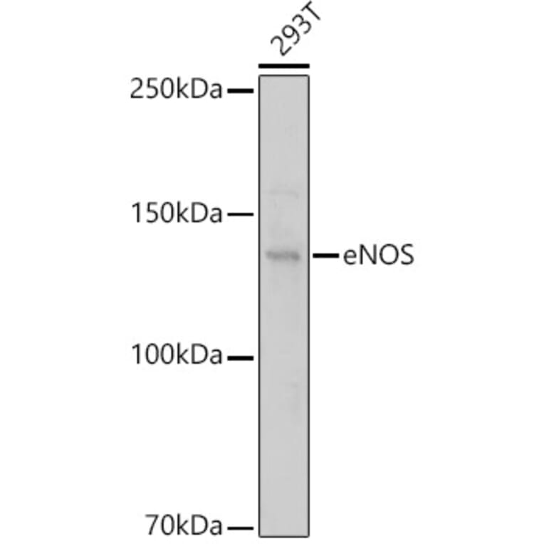 Western Blot - Anti-eNOS Antibody (A91724) - Antibodies.com