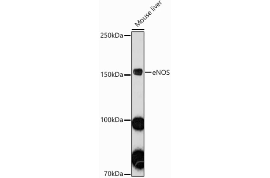 Western Blot - Anti-eNOS Antibody (A91724) - Antibodies.com