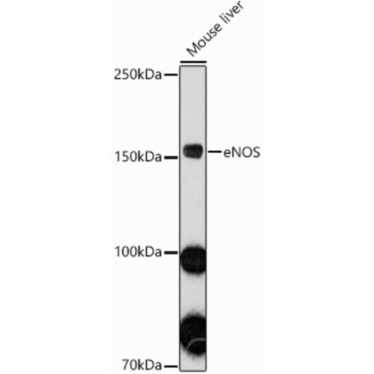 Western Blot - Anti-eNOS Antibody (A91724) - Antibodies.com