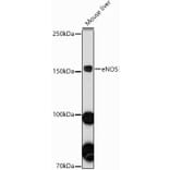 Western Blot - Anti-eNOS Antibody (A91724) - Antibodies.com