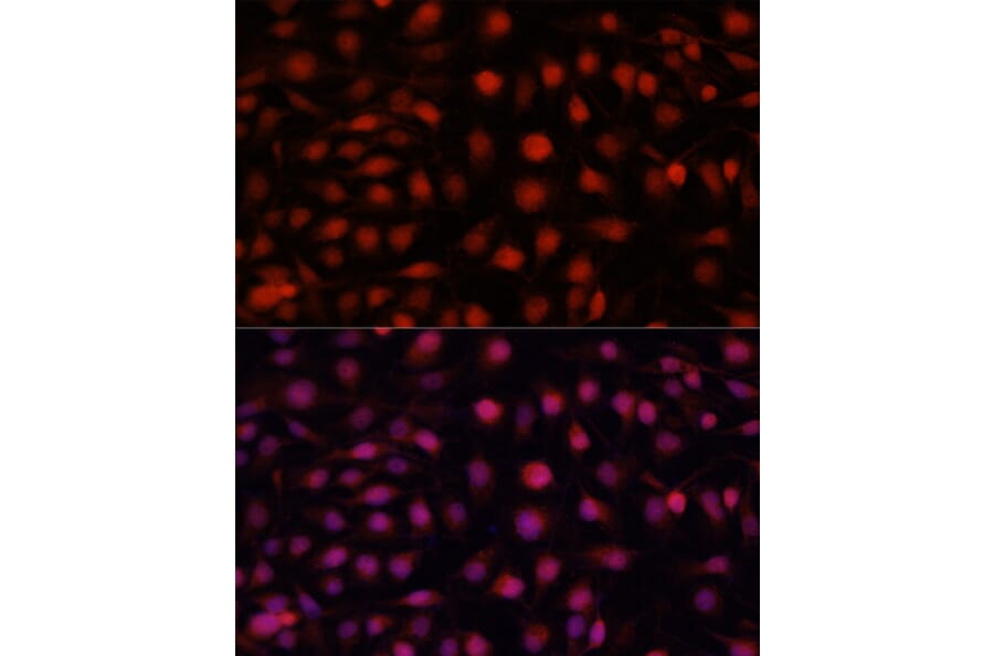 Immunofluorescence - Anti-eNOS Antibody (A91724) - Antibodies.com