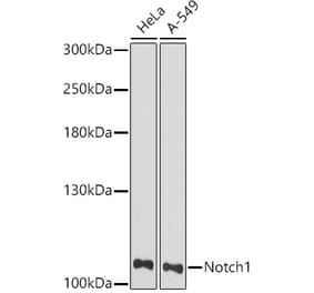 Western Blot - Anti-Notch1 Antibody (A91725) - Antibodies.com