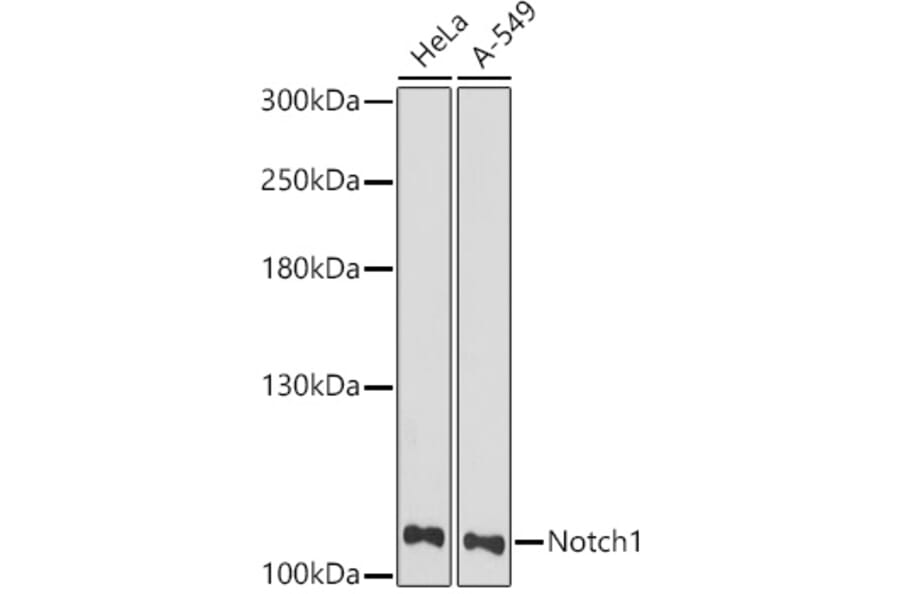 Western Blot - Anti-Notch1 Antibody (A91725) - Antibodies.com
