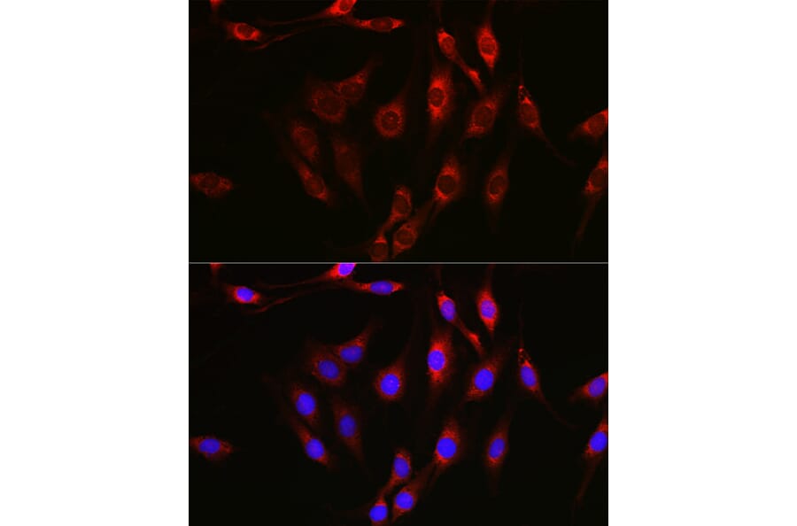 Immunofluorescence - Anti-Notch1 Antibody (A91725) - Antibodies.com