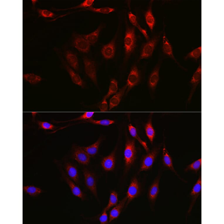 Immunofluorescence - Anti-Notch1 Antibody (A91725) - Antibodies.com
