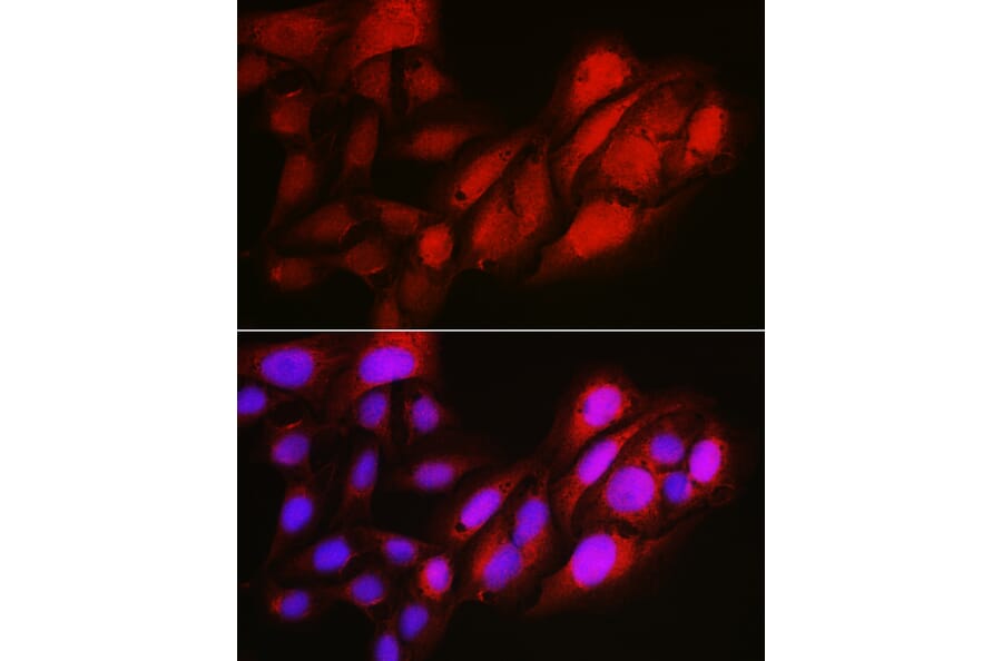 Immunofluorescence - Anti-Notch1 Antibody (A91725) - Antibodies.com