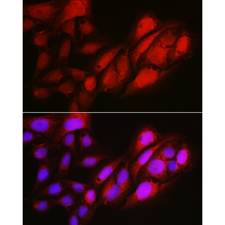 Immunofluorescence - Anti-Notch1 Antibody (A91725) - Antibodies.com