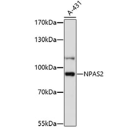 Western Blot - Anti-NPAS2 Antibody (A91726) - Antibodies.com