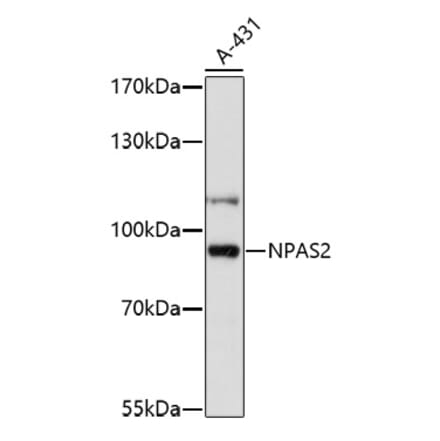 Western Blot - Anti-NPAS2 Antibody (A91726) - Antibodies.com