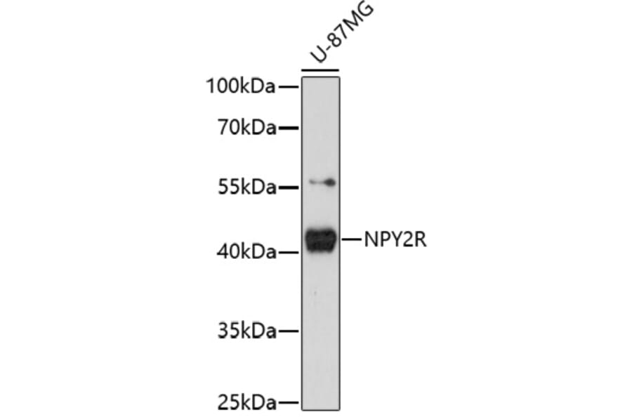 Western Blot - Anti-NPY2R/Y2 receptor Antibody (A91727) - Antibodies.com