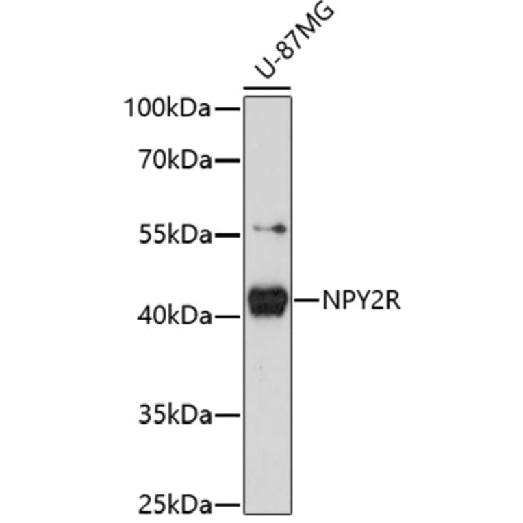 Western Blot - Anti-NPY2R/Y2 receptor Antibody (A91727) - Antibodies.com