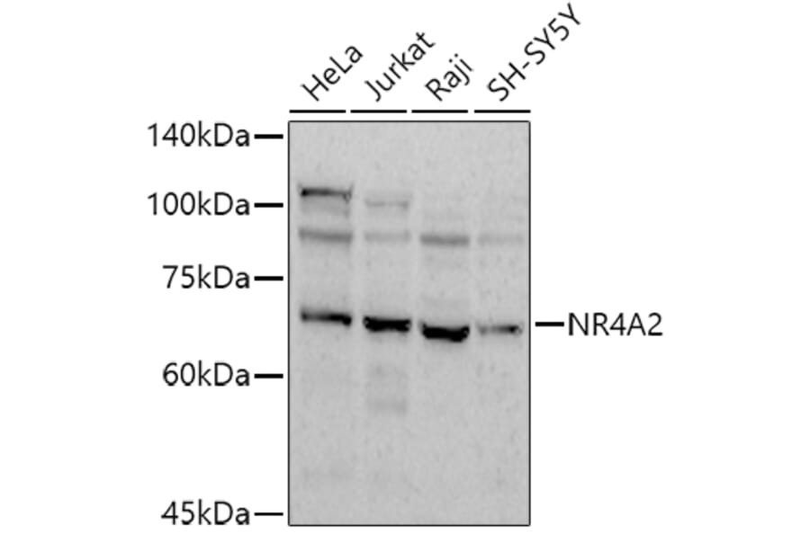 Western Blot - Anti-Nurr1 Antibody (A91728) - Antibodies.com