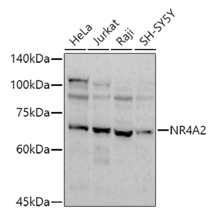 Western Blot - Anti-Nurr1 Antibody (A91728) - Antibodies.com