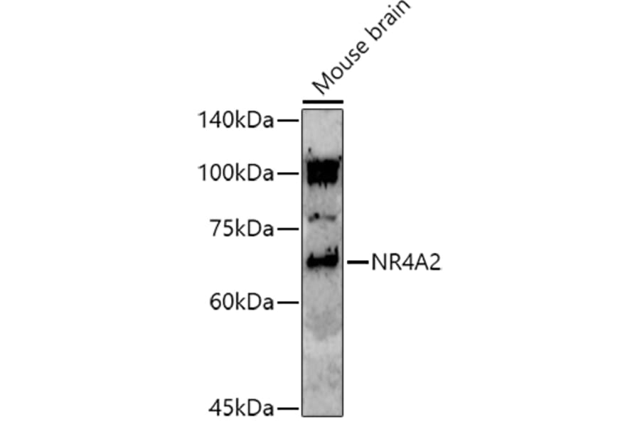 Western Blot - Anti-Nurr1 Antibody (A91728) - Antibodies.com