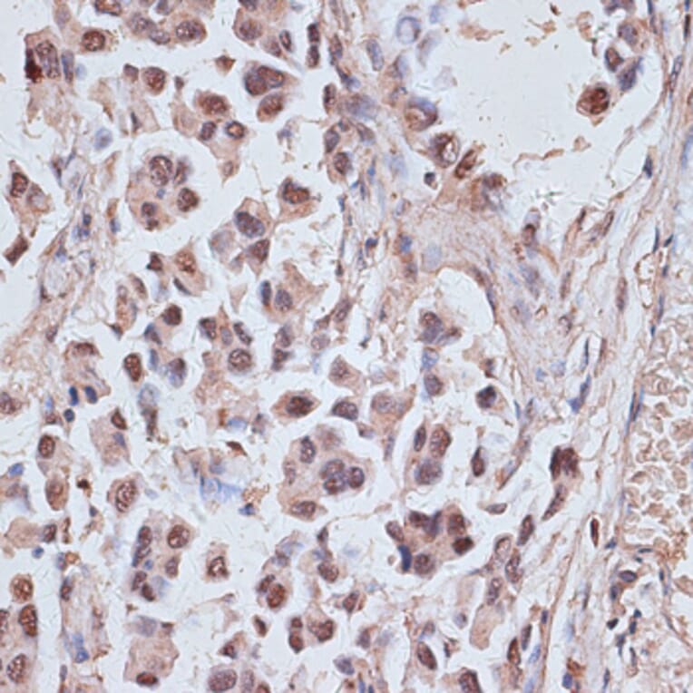 Immunohistochemistry - Anti-NR5A2 / LRH1 Antibody (A91729) - Antibodies.com