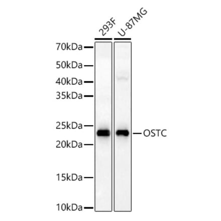 Western Blot - Anti-OSTC Antibody (A91730) - Antibodies.com