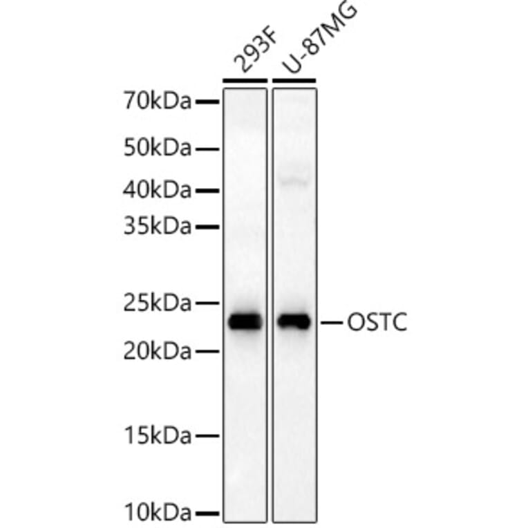 Western Blot - Anti-OSTC Antibody (A91730) - Antibodies.com