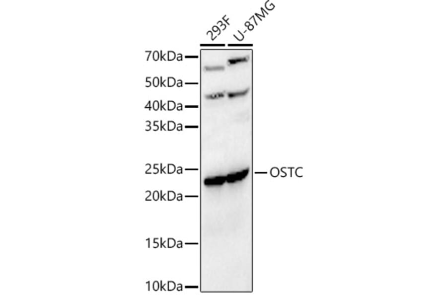 Western Blot - Anti-OSTC Antibody (A91730) - Antibodies.com