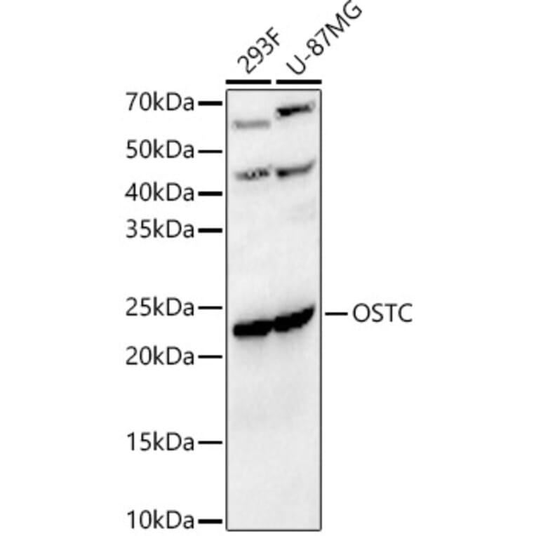 Western Blot - Anti-OSTC Antibody (A91730) - Antibodies.com