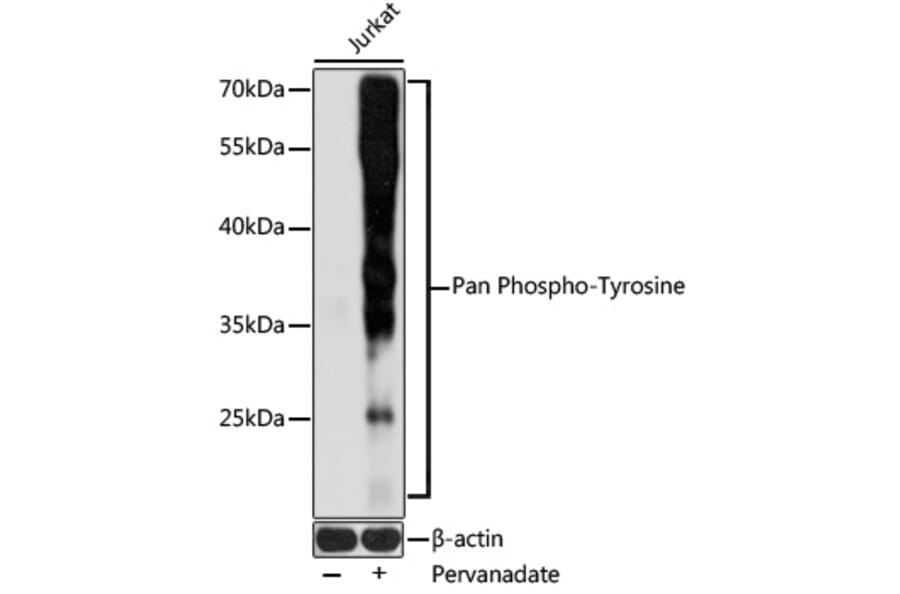 Western Blot - Anti-pan phospho Tyrosine Antibody (A91731) - Antibodies.com