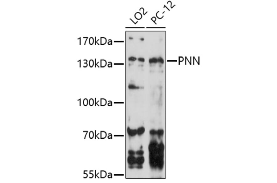 Western Blot - Anti-PNN / DRSP Antibody (A91736) - Antibodies.com