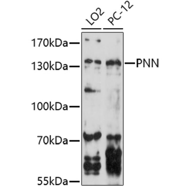 Western Blot - Anti-PNN / DRSP Antibody (A91736) - Antibodies.com